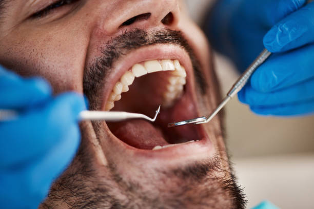 Best Tooth Infection Emergency Dentist  in Penns Grove, NJ